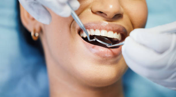 Best Cosmetic Emergency Dentistry in Lynwood, CA